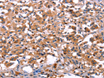 Anti-LILRB1 Antibody