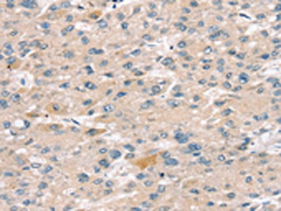 Anti-SULT2B1 / Sulfotransferase 2B1 Antibody