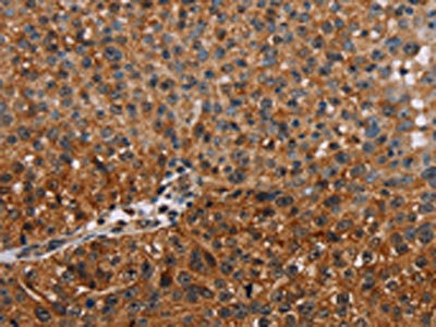 Anti-NMT2 Antibody