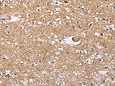 Anti-SOCS2 Antibody