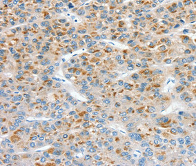 Anti-CCS / Sod-4 Antibody