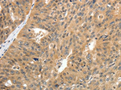 Anti-CNNM3 Antibody