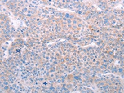 Anti-SPATA6 Antibody