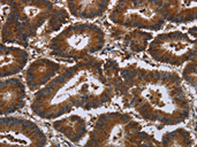 Anti-CERS5 / Ceramide synthase 5 Antibody