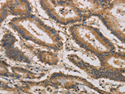 Anti-CLEC5A Antibody