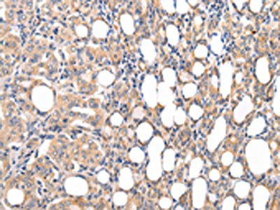 Anti-CMKLR1 Antibody
