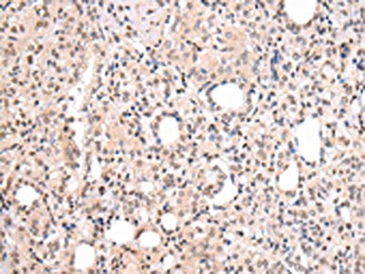 Anti-CBX7 Antibody