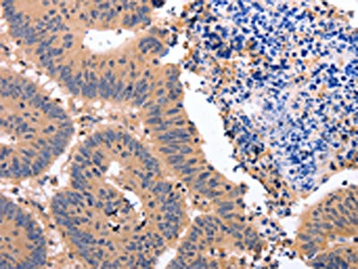 Anti-NR3C1 Antibody