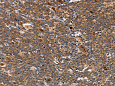 Anti-STK4 / Serine/threonine-protein kinase 4 Antibody