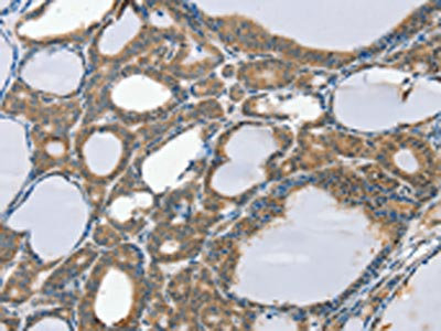 Anti-SCD Antibody