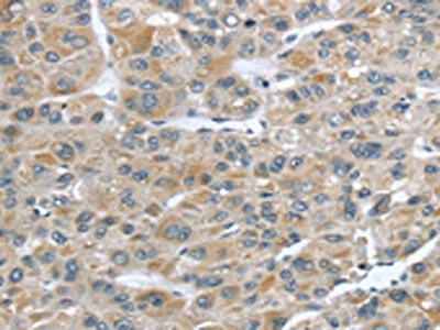 Anti-CFAP45 Antibody