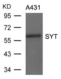 Anti-SS18 Antibody