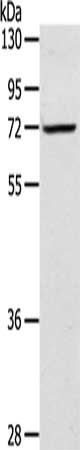 Anti-LTA4H Antibody