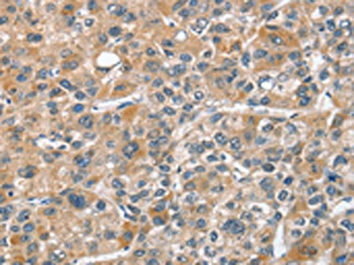 Anti-CHMP4B Antibody