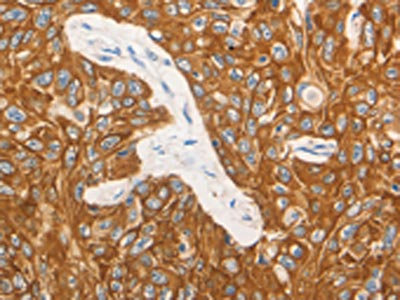 Anti-CSF3 Antibody