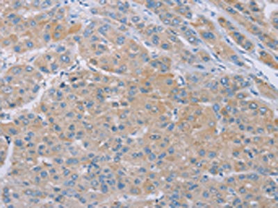 Anti-SAMD4B Antibody