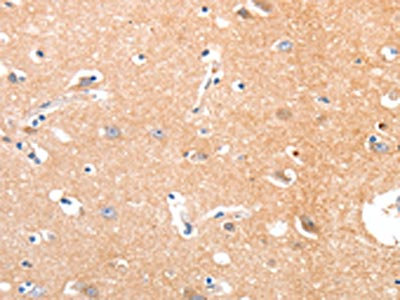 Anti-MAPK8 Antibody
