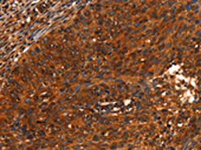 Anti-PRKD1 Antibody