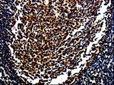 Anti-MAGEA4 Antibody