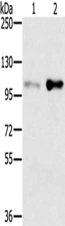 Anti-SLTM Antibody
