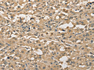 Anti-ALDH8A1 Antibody