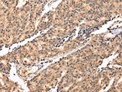Anti-SWAP70 / Switch associated protein 70 Antibody
