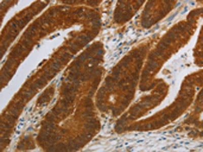Anti-NIT2 Antibody