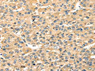 Anti-STX18 / Syntaxin 18 Antibody