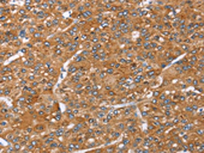 Anti-PAICS Antibody