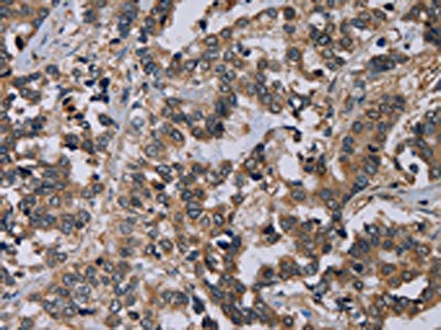 Anti-PVRL4 Antibody
