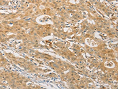 Anti-PGK2 Antibody