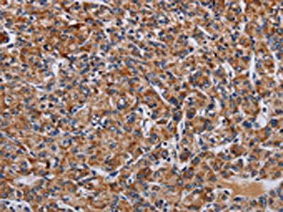 Anti-LRRC15 Antibody