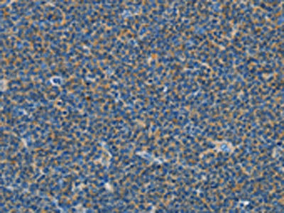 Anti-COX7B2 Antibody