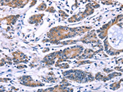 Anti-SYT4 / Synaptotagmin 4 Antibody