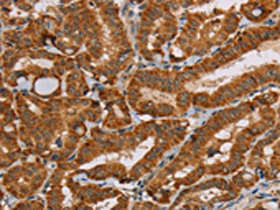 Anti-MSR1 Antibody