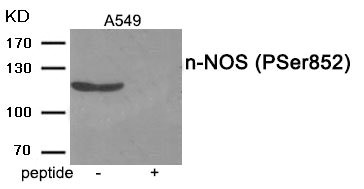 Anti-Phospho-NOS1 (Ser852) Antibody