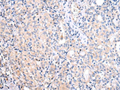 Anti-ATF6 / Cyclic AMP-dependent transcription factor ATF-6 alpha Antibody