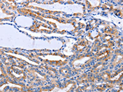 Anti-LIF Antibody