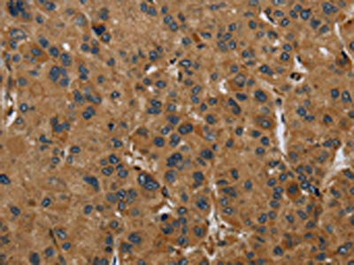 Anti-PAEP Antibody