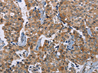 Anti-PLXNA4 Antibody