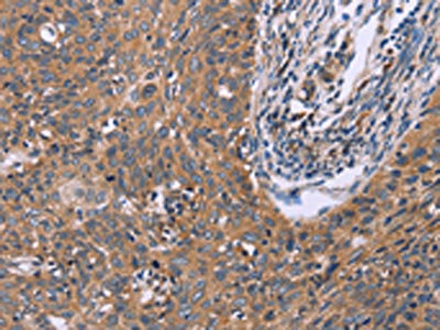Anti-CSF2RB Antibody