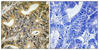 Anti-Phospho-EIF4EBP1 (Thr70) Antibody