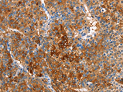 Anti-CBS Antibody