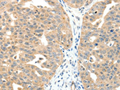 Anti-MAP3K14 Antibody