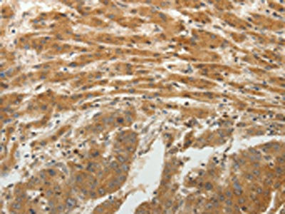Anti-SPATA17 Antibody