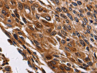 Anti-RAB41 Antibody