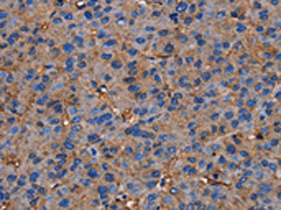 Anti-NRIP3 Antibody