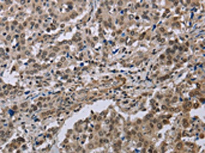 Anti-MGLL Antibody