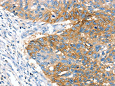 Anti-CRADD Antibody