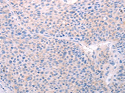 Anti-SPATA6 Antibody